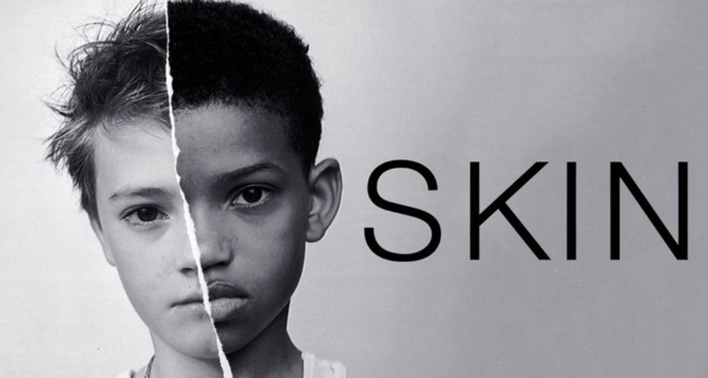 movies like Skin.jpg